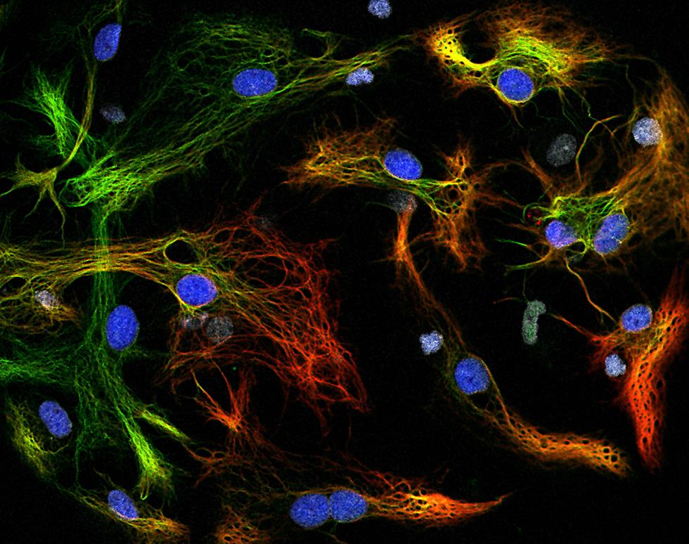 Neural stem cells - quadruple staining